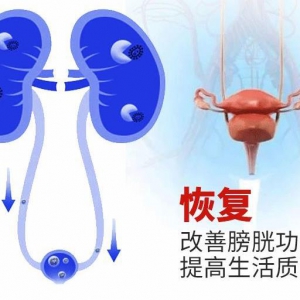 膀胱炎有哪些症状 男性如何预防膀胱炎发病